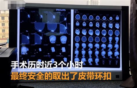 为生男孩女子困产床15年未果,