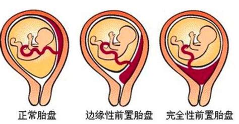 孕妇8个月吃什么好对胎儿好