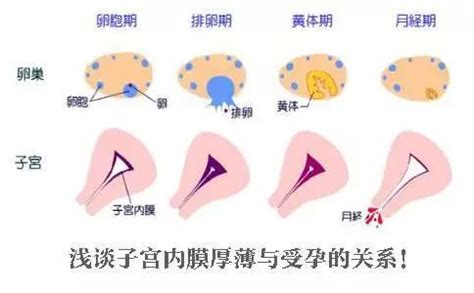 子宫壁膨出程度