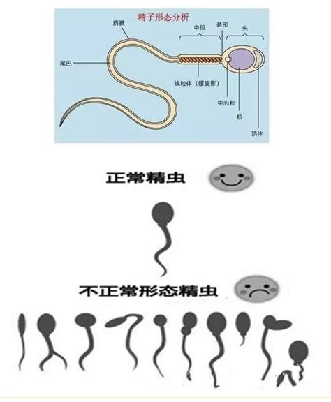 男科医院精子检查怎么取精