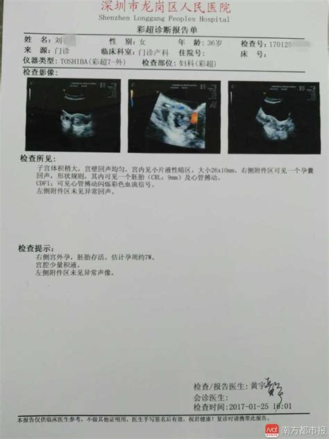 怀孕的贵州福泉医院b超单图片