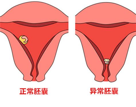 孕妇异常胎心的表现是什么