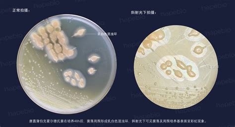 Burkholderia cenocepacia