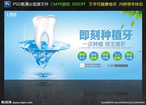 牙齿种植广告