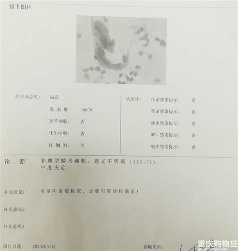 宫颈妊娠是什么意思