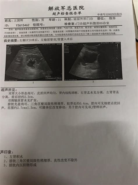 小儿有疳积怎么办