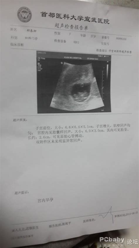 孕8周只有心管搏动听不见胎心
