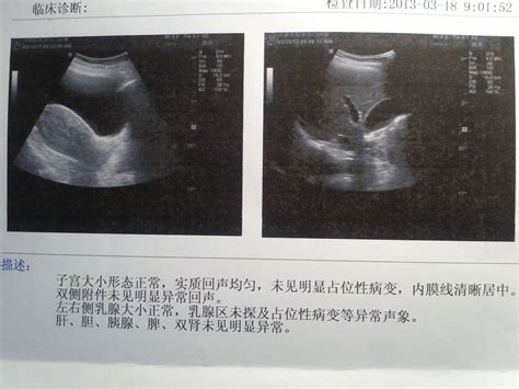 彩超可以检查肠道吗