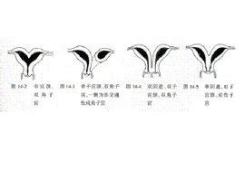 宫体大小41*34*25正常吗