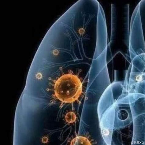 新冠状病毒会通过蚊子传播吗