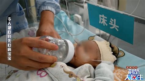 四维能查出先心病吗