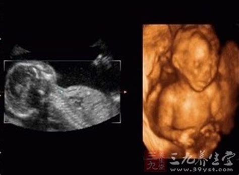 孕妇做胎儿心脏彩超注意事项