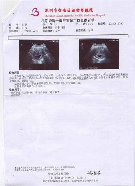 hcg7000多能看见孕囊吗