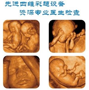 怀孕7个月的胎儿发育状况