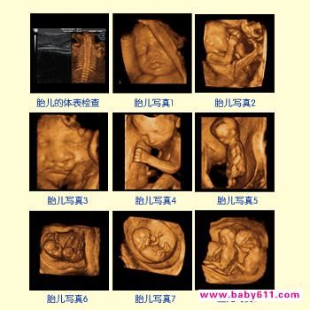孕24周胎儿的发育情况