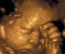 胎儿在二十周时的发育情况