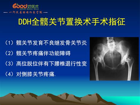 子宫发育不良的中医治疗