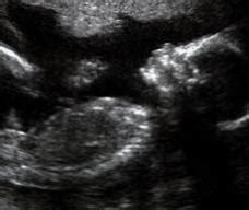 怀孕七到八个月的胎教音乐