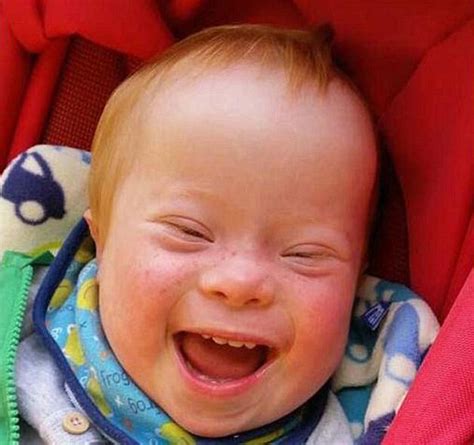 唐氏综合征是什么原因造成的