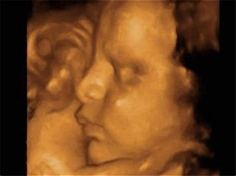 怀孕胎儿发育不良什么原因