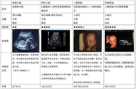 14周胎儿三维彩超图片