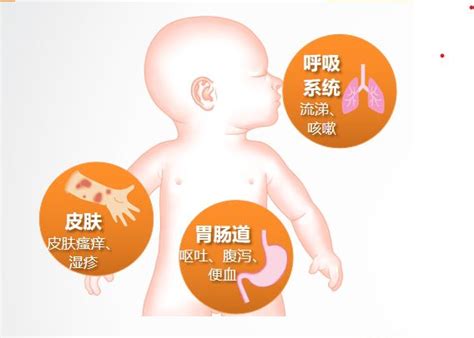 小孩子患过敏性鼻炎是什么原因导致的