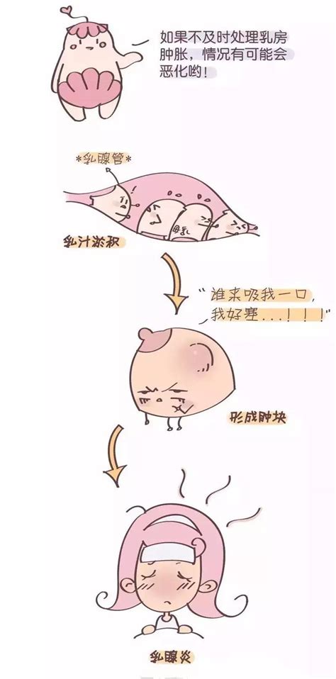 经常堵奶是不是容易引发乳腺癌