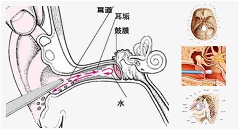 骨传导耳机优缺点有哪些?