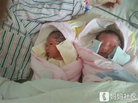 双胞胎是两个胎心吗