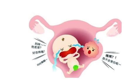 甲状腺怀孕对胎儿有影响吗