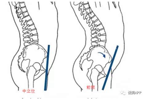 耻骨上方小腹一摁就疼