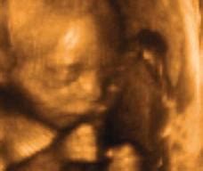 怀孕中期胎儿发育状况及注意事项