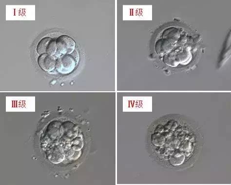 胚胎移植后着床失败胚胎会排出来吗?