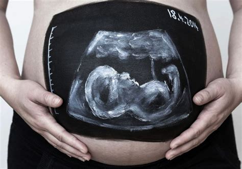 孕期多做了几次b超对胎儿有影响吗