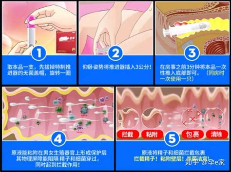 排卵期出血可以剧烈运动吗