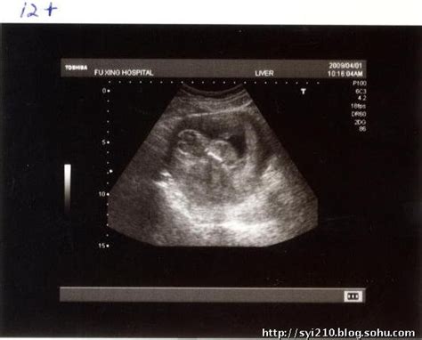怀孕图片1到10月