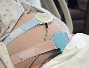 为什么做胎心监测时宝宝会缺氧