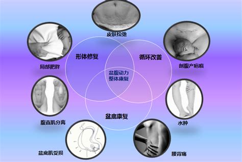 剖腹产需要做盆底修复治疗吗