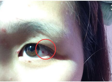 流血一个月不停怎么办