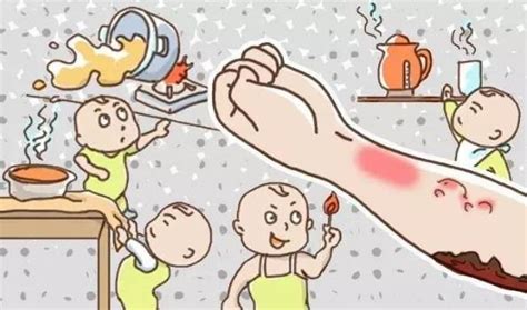 烫伤千万别涂抹酱油