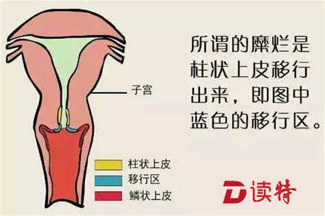 宫体大小为46x39x46mm算正常吗