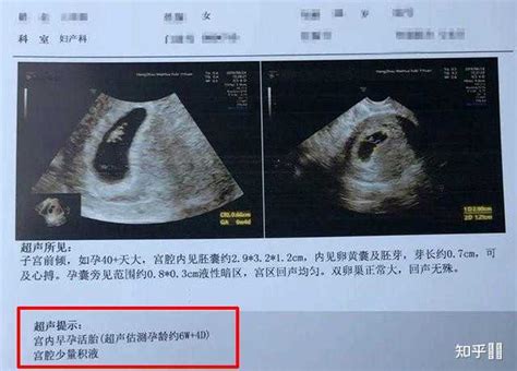 怀孕初期b超图片造假