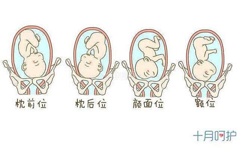 怀孕子宫前位和子宫后位有什么区别