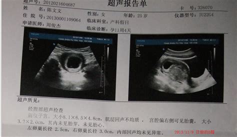 孕8周查不到胎芽卵黄囊