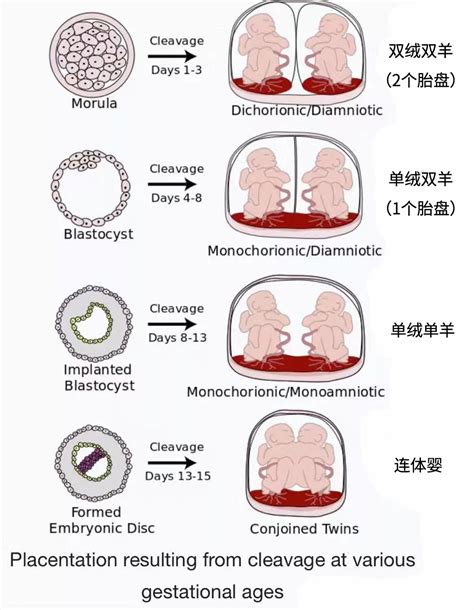 同卵双胞胎为什么长得不一样