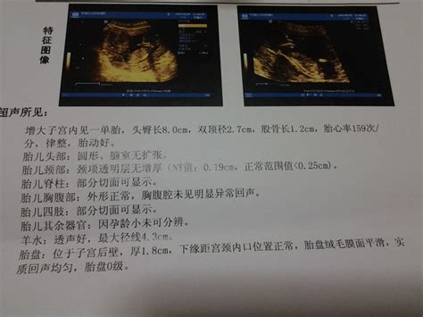 四维检查多少钱做一次