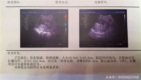 从四维报告里能看出上怀下怀不