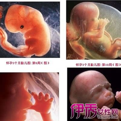 孕1-20周胎儿真实图