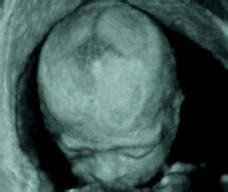 二十三周的胎儿发育情况