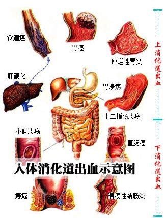 孕期性生活出血是怎么回事